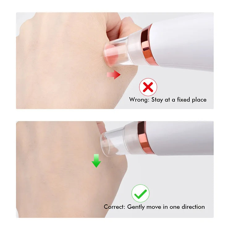 Electric Blackhead Remover Vacuum