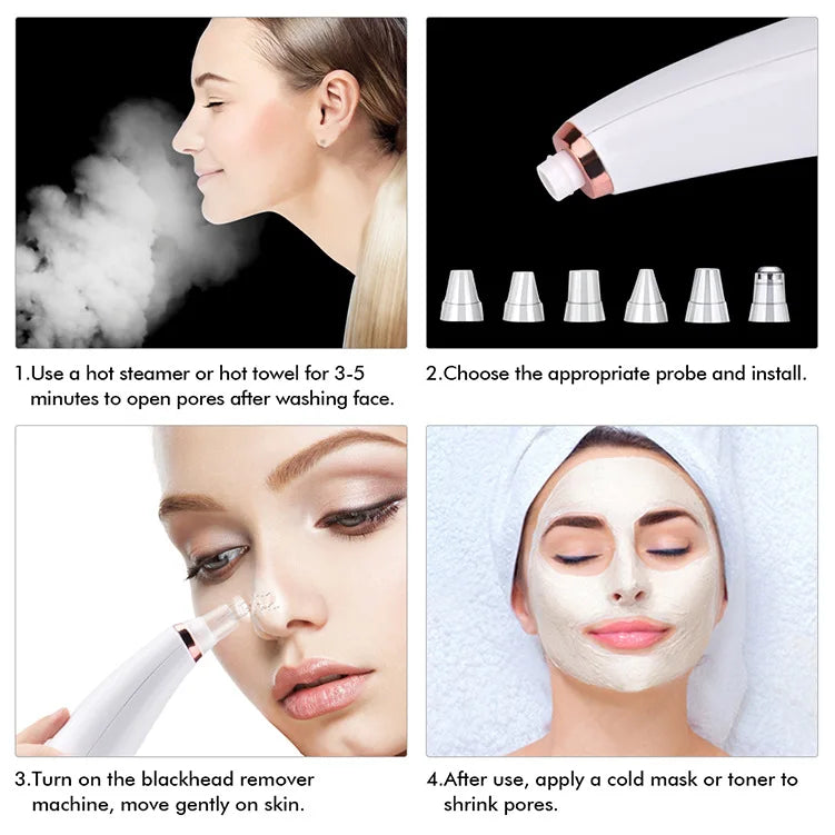 Electric Blackhead Remover Vacuum