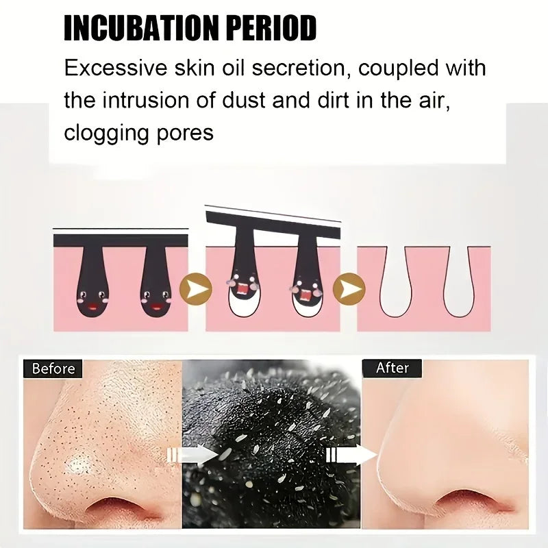 Deep Cleansing Nose Strips